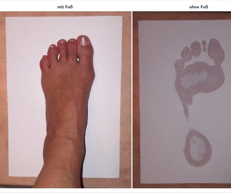 Der Endkunde fotografiert mit dem Smartphone erst seinen nassen Fuß auf einem DIN-A4-Papier, dann den Fußabdruck.