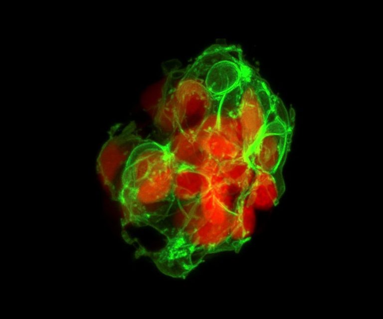 Eine Ansammlung von Beta-Zellen in der Bauchspeicheldrüse eines Zebrafischs.